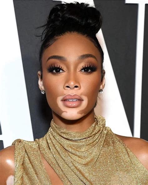 winnie harlow wikipedia